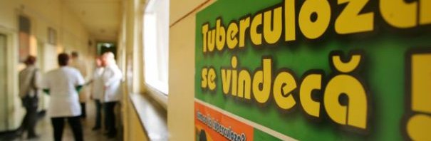 tuberculoza