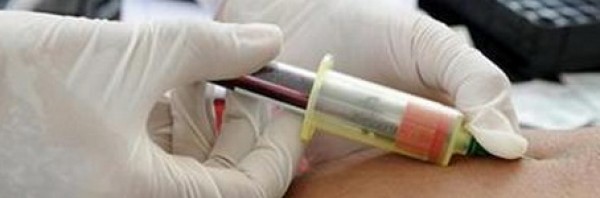 test_HIV