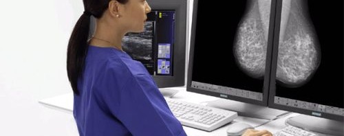 mamografii