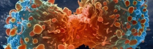 cancer