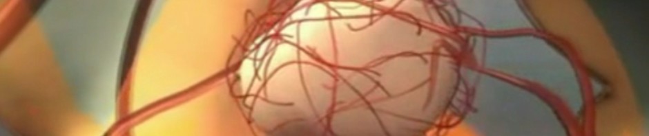 fibrom